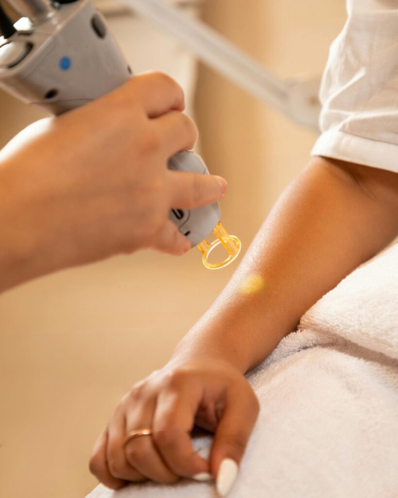 Manipolo grigio con puntale giallo trasparente che proietta luce sull'avambraccio di una donna disteso su un telo bianco
